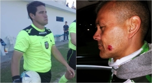 Violencia en el fútbol de Paraná: un árbitro de Santa Elena mordió al integrante de un cuerpo técnico
