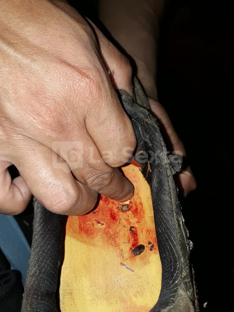 herida obra incompleta santa elena 2 result