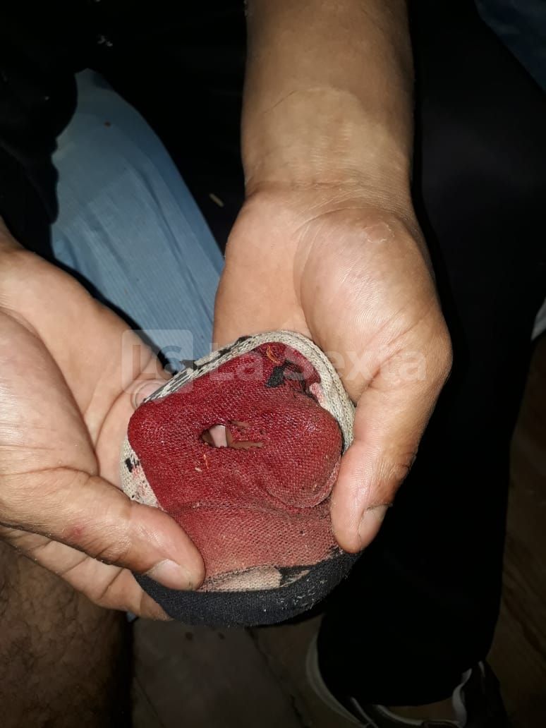 herida obra incompleta santa elena result