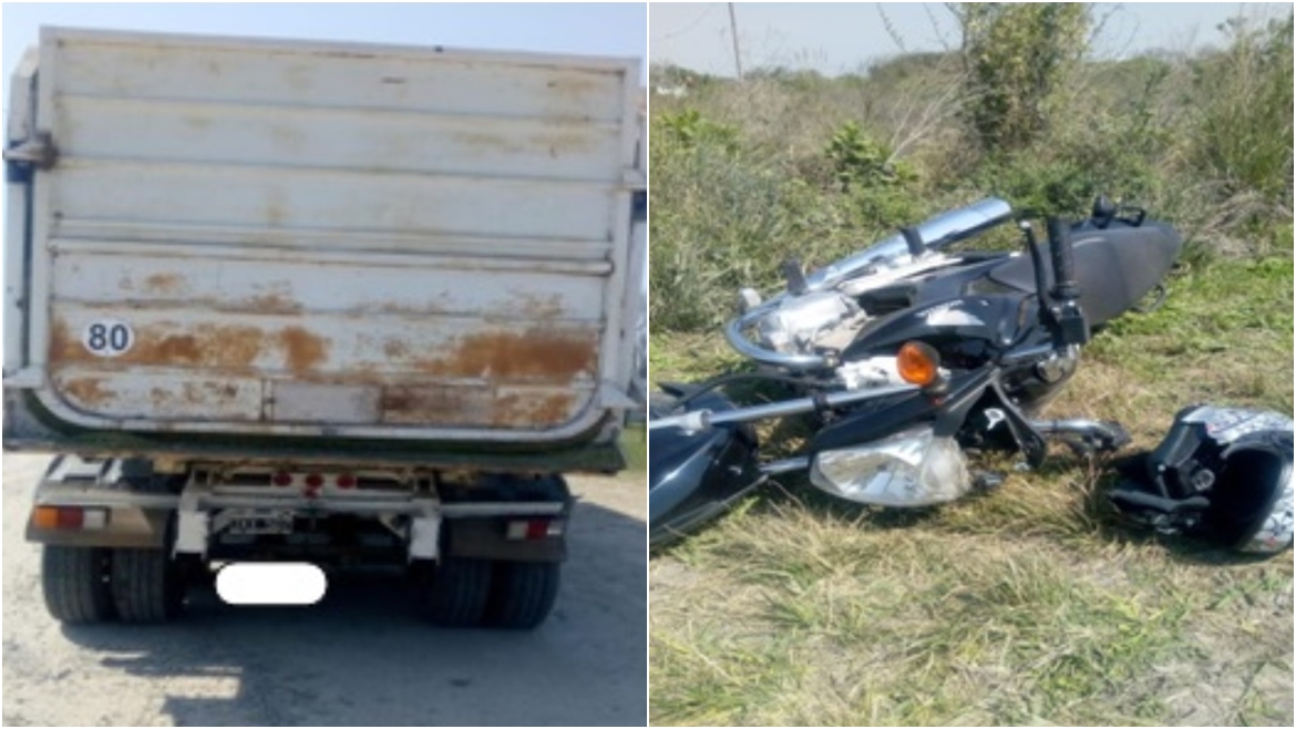 siniestro vial maxilar